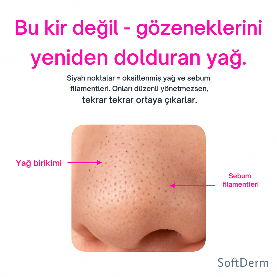 SoftDerm™ Mikro Darbeli Gözenek Temizleme Cihazı