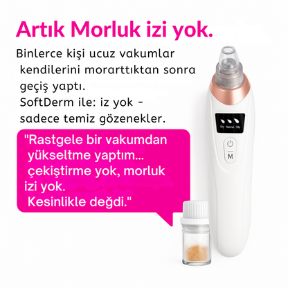 SoftDerm™ Mikro Darbeli Gözenek Temizleme Cihazı